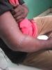 Violences urbaines - jeune homme de 44 ans agressé à Makélékélé Brazzaville